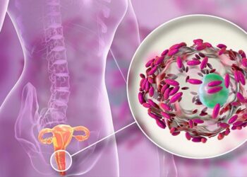 Lo que debe saber sobre la vaginosis bacteriana, síntomas y factores de riesgo